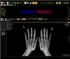 hand x-ray system for sale