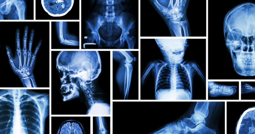 Digital Radiography - Old Film vs. Digital Images - Proximus Medical 